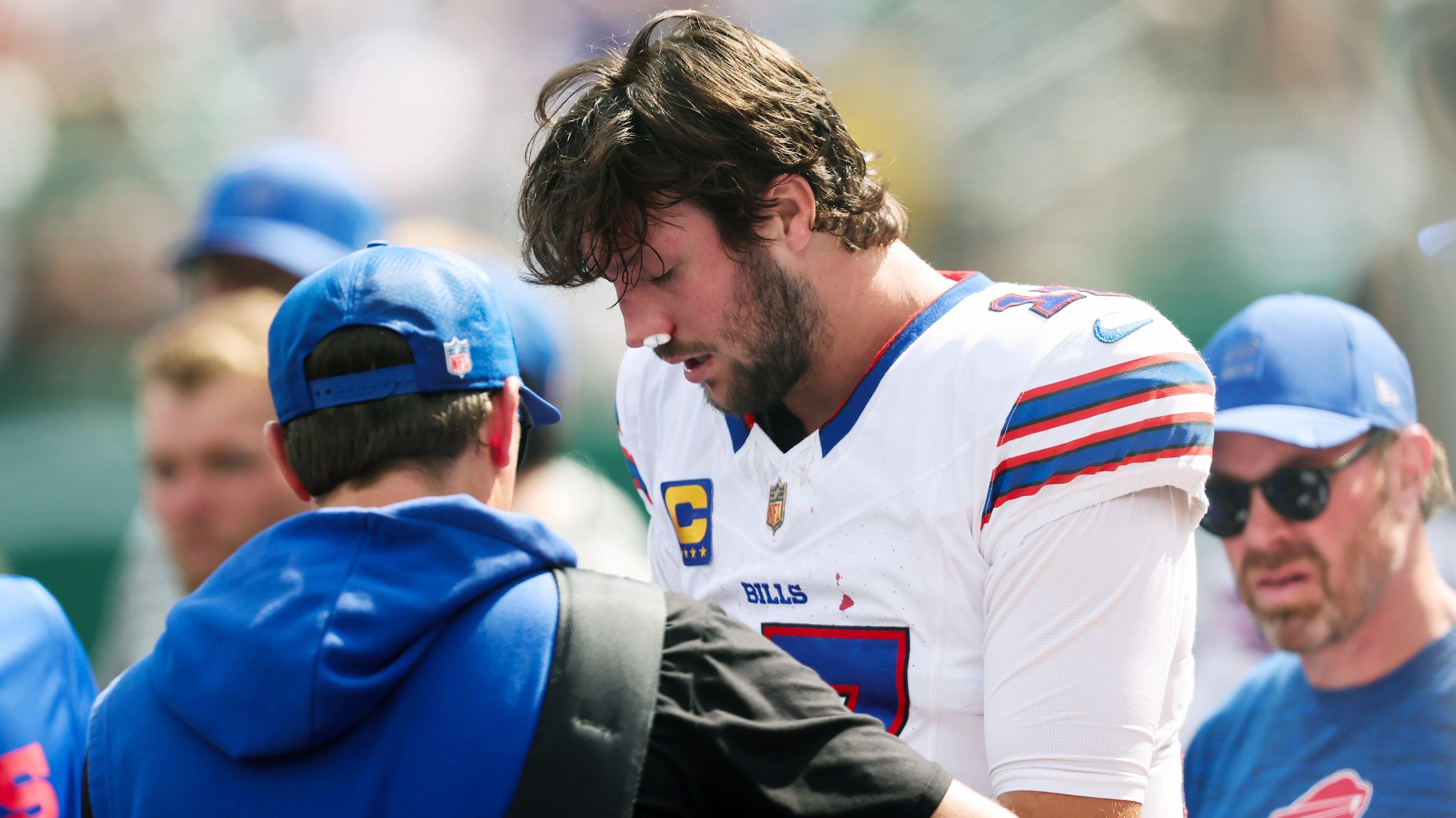 Bufalo Bills quarterback Josh Allen obtains procedure for a nostrils personal injury